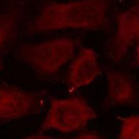 IF - Anti-active Caspase 3 Antibody AP61575